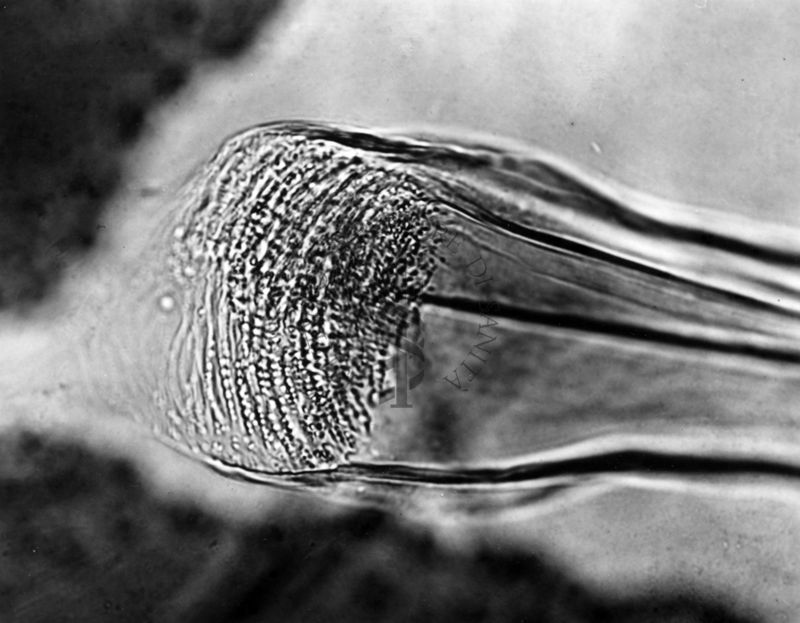 Differenze morfologiche fra le specie Ph. Perniciosus e Ph. Perfiliewi