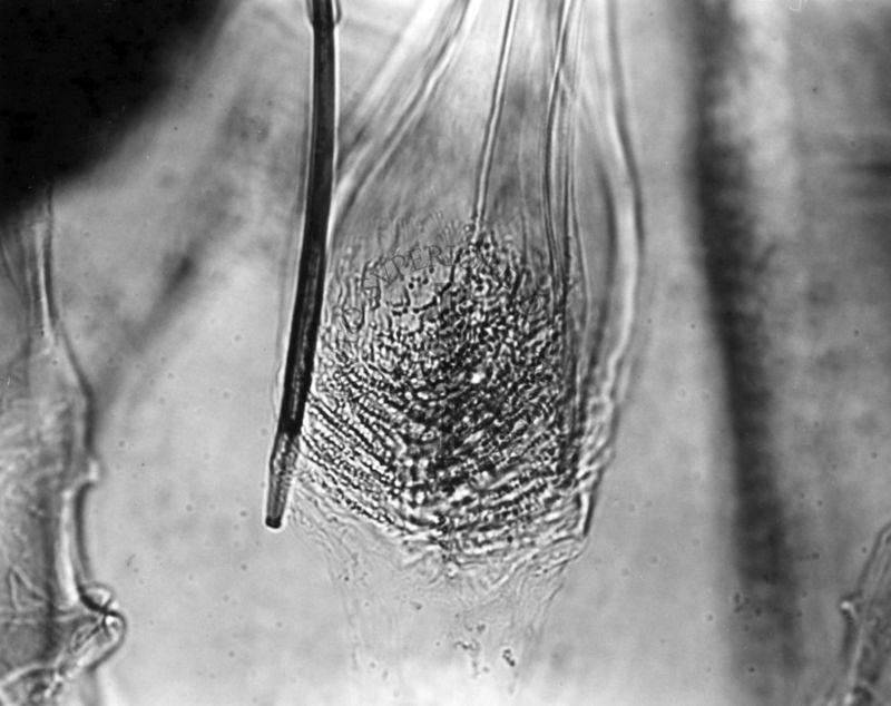 Differenze morfologiche fra le specie Ph. Perniciosus e Ph. Perfiliewi