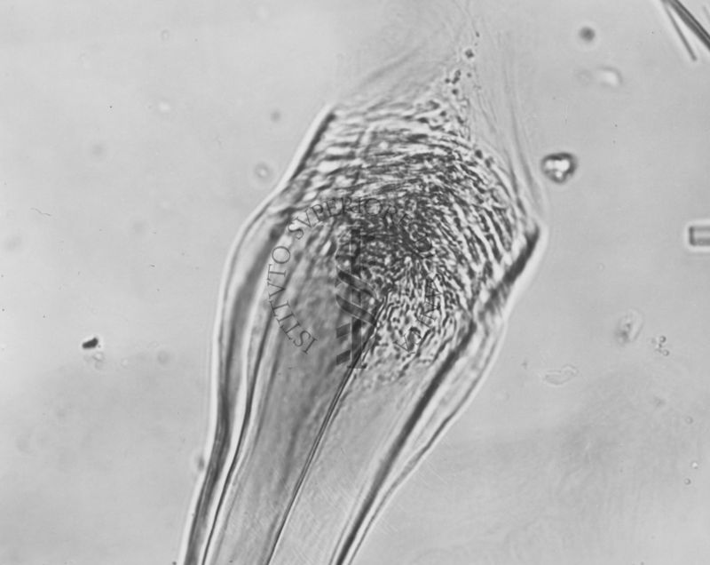 Differenze morfologiche fra le specie Ph. Perniciosus e Ph. Perfiliewi