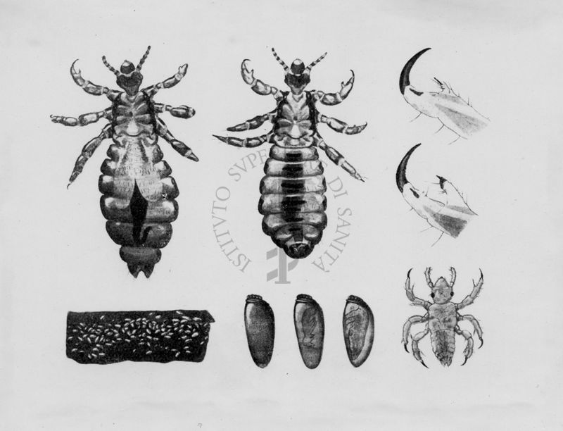 Pediculus humanus corporis, nella fase adulta, di uova e di larva; in alto a destra è rappresentato l'estremo distale delle zampe anteriori