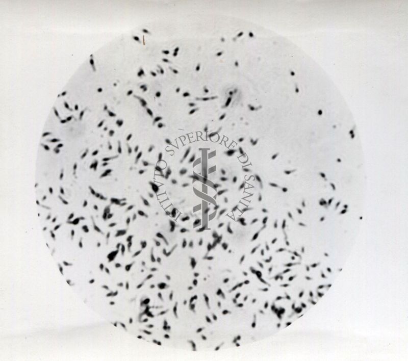 Immagini di Mycobacterium phlei