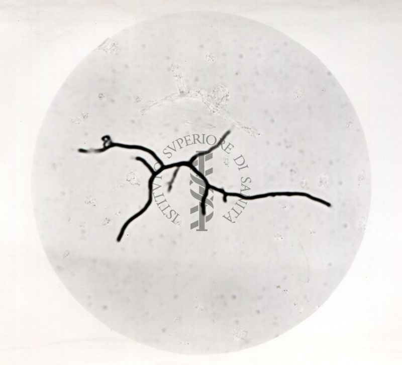 Actinomyces viridis (batterio Gram-positivo).