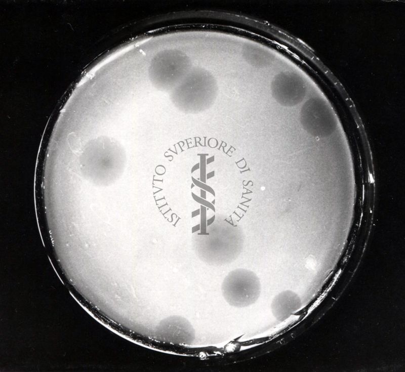 Phagus fromani su Myc. Tubercolosis ceppo H 37