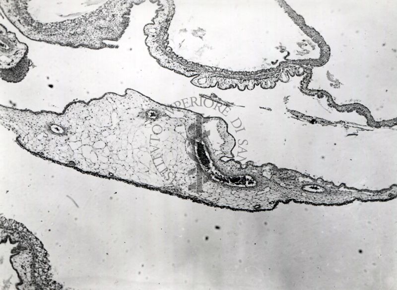 Sezione istologica di membrana corio-allantoidea (trovabile nelle uova di uccelli e rettili formata dalla fusione del mesoderma di 2 strutture embriologiche: allantoide e il corion) inoculata con materiale penfigoso