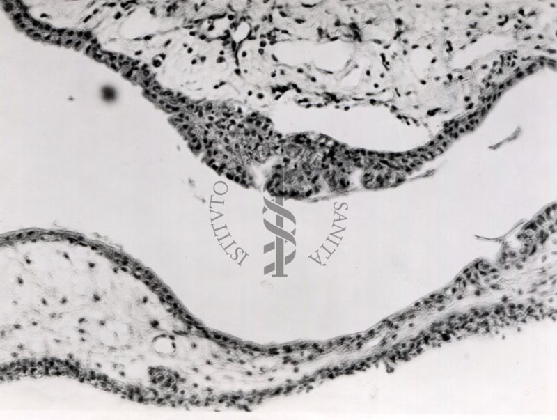 Sezione istologica di membrana corio-allantoidea (trovabile nelle uova di uccelli e rettili formata dalla fusione del mesoderma di 2 strutture embriologiche: allantoide e il corion) inoculata con materiale penfigoso