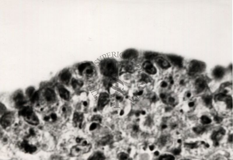 Sezione istologica di membrana corio-allantoidea (trovabile nelle uova di uccelli e rettili formata dalla fusione del mesoderma di 2 strutture embriologiche: allantoide e il corion) inoculata con materiale penfigoso