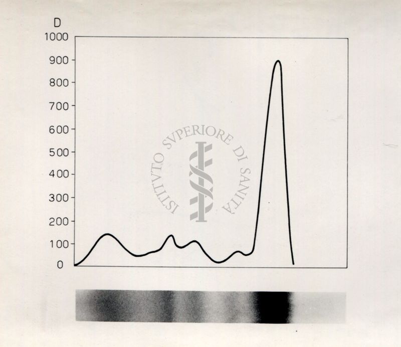 Grafico riguardante lo studio sulle proteine seriche in soggetti portatori di neoplasie trattati con raggi X