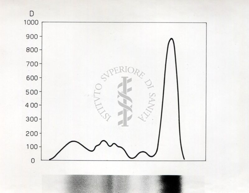 Grafico riguardante lo studio sulle proteine seriche in soggetti portatori di neoplasie trattati con raggi X