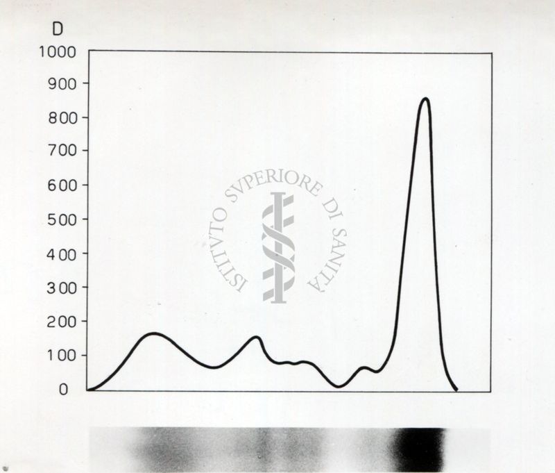 Grafico riguardante lo studio sulle proteine seriche in soggetti portatori di neoplasie trattati con raggi X