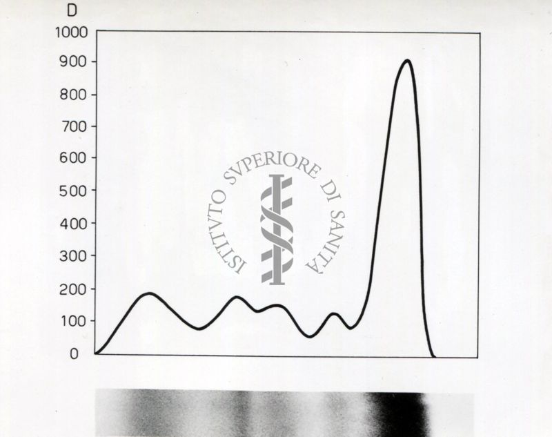 Grafico riguardante lo studio sulle proteine seriche in soggetti portatori di neoplasie trattati con raggi X