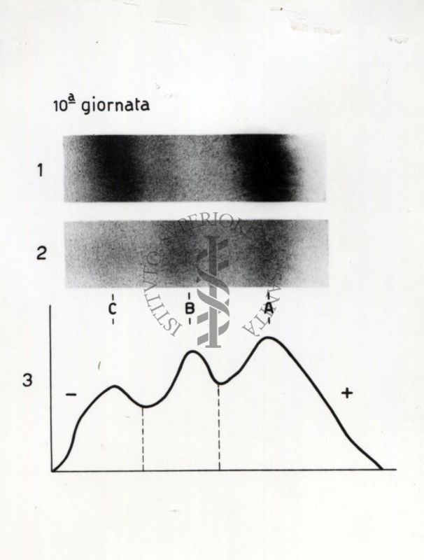 Elettroforesi di liquido allantoideo (riguardante un annesso embrionale) di embrione di pollo