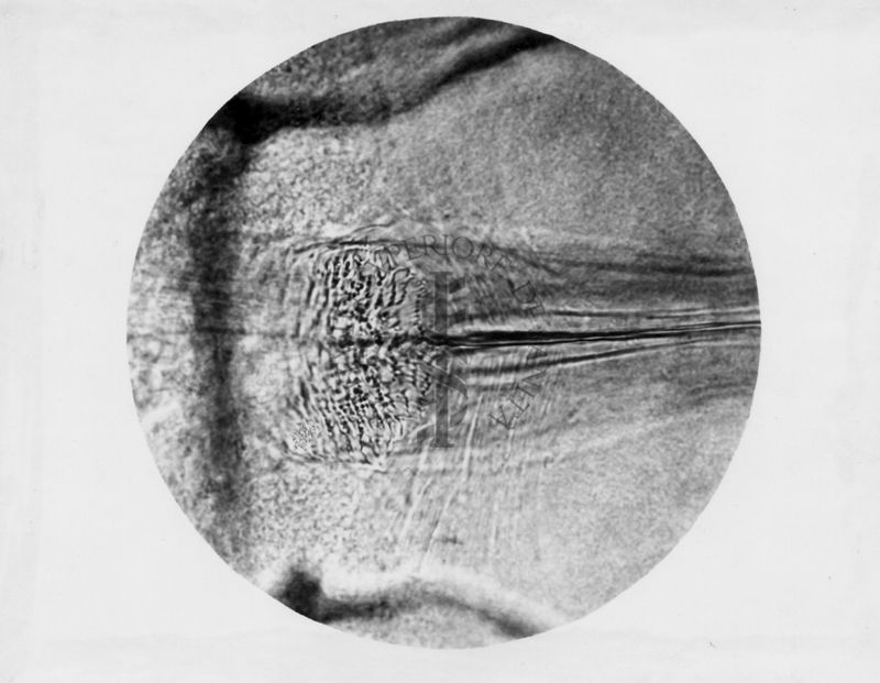 Immagine di differenze morfologiche fra le specie Phlebotomus perniciosus e Phlebotomus perfiliewi. Flebotomi.