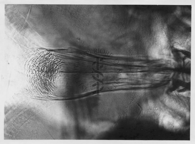 Immagine di differenze morfologiche fra le specie Phlebotomus perniciosus e Phlebotomus perfiliewi. Flebotomi.