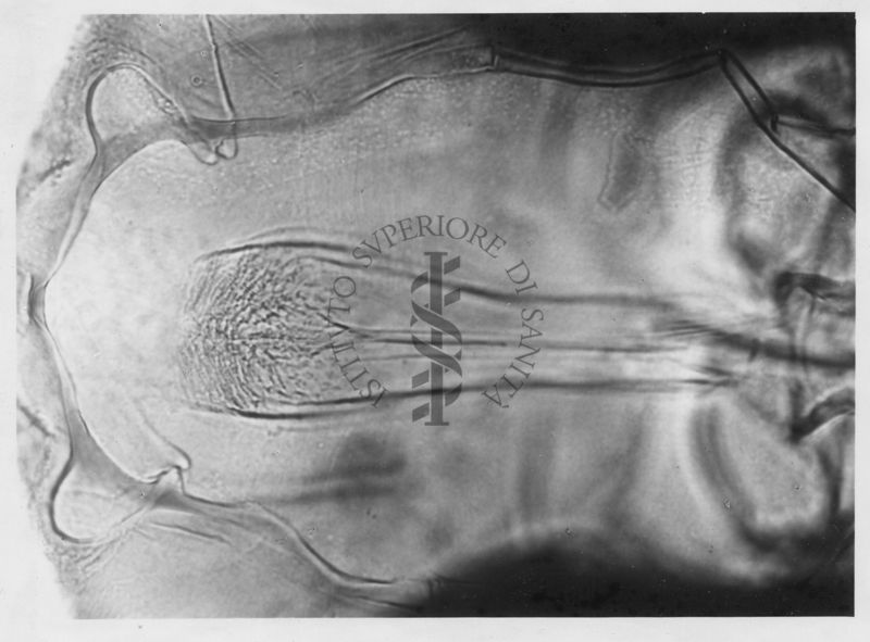 Differenze morfologiche tra le specie Phlebotomus perniciosus e Phlebotomus perfiliewi