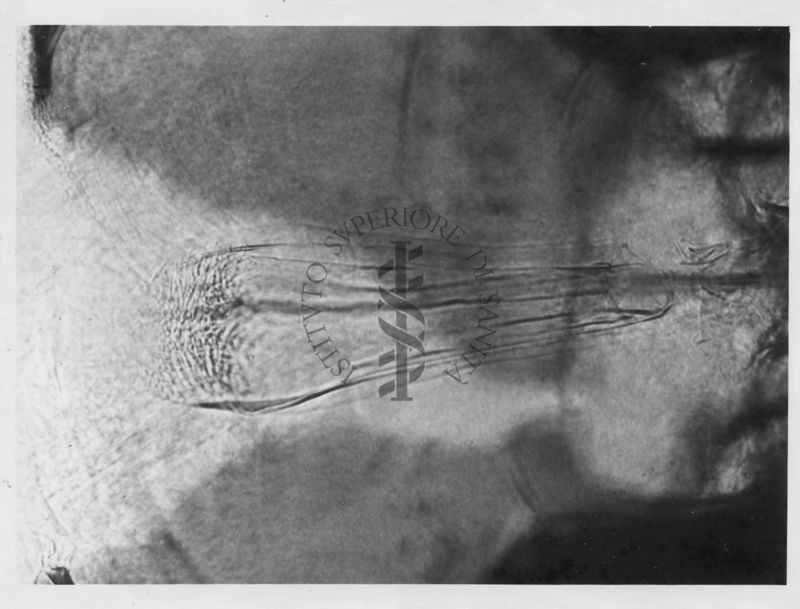 Differenze morfologiche tra le specie Phlebotomus perniciosus e Phlebotomus perfiliewi