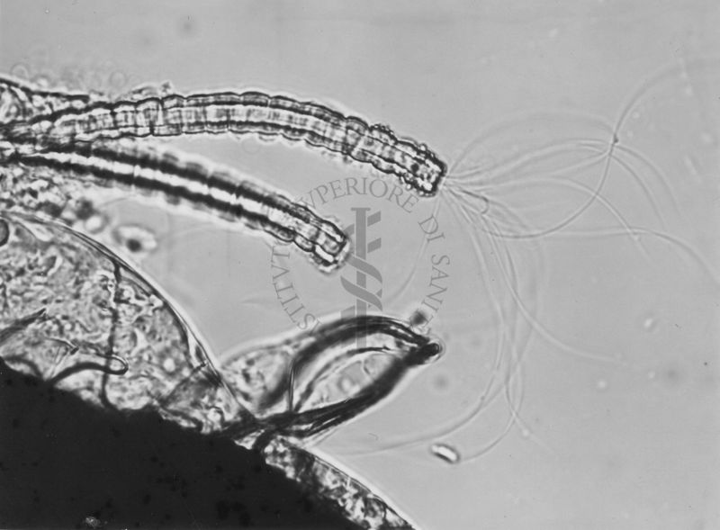 Parti di organi genitali di Musca domestica L. La mosca domestica è un insetto dell'ordine dei Ditteri, appartenente alla famiglia dei Muscidi