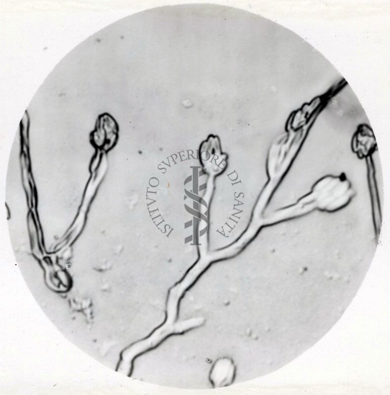 Saccaromiceti. Saccharomyces è un genere del regno dei funghi che include molte specie di lieviti. Il termine deriva dal latino: fungo dello zucchero.