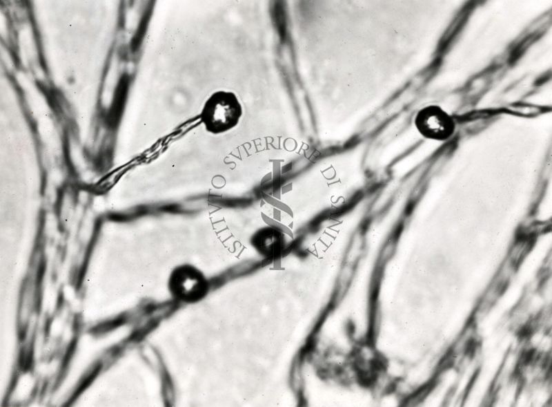 Saccaromiceti. Saccharomyces è un genere del regno dei funghi che include molte specie di lieviti. Il termine deriva dal latino: fungo dello zucchero.