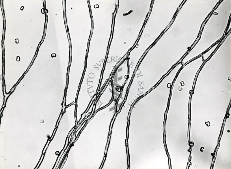 Saccaromiceti. Saccharomyces è un genere del regno dei funghi che include molte specie di lieviti. Il termine deriva dal latino: fungo dello zucchero.