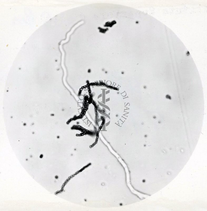 Saccaromiceti. Saccharomyces è un genere del regno dei funghi che include molte specie di lieviti. Il termine deriva dal latino: fungo dello zucchero.