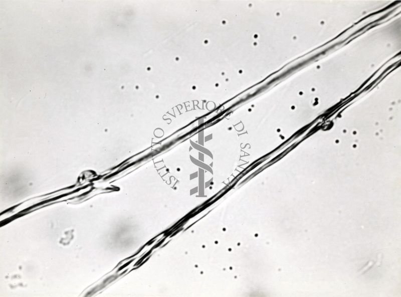 Saccaromiceti. Saccharomyces è un genere del regno dei funghi che include molte specie di lieviti. Il termine deriva dal latino: fungo dello zucchero.