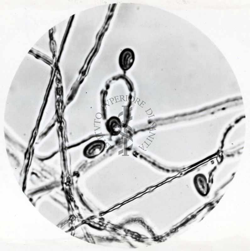 Saccaromiceti. Saccharomyces è un genere del regno dei funghi che include molte specie di lieviti. Il termine deriva dal latino: fungo dello zucchero.