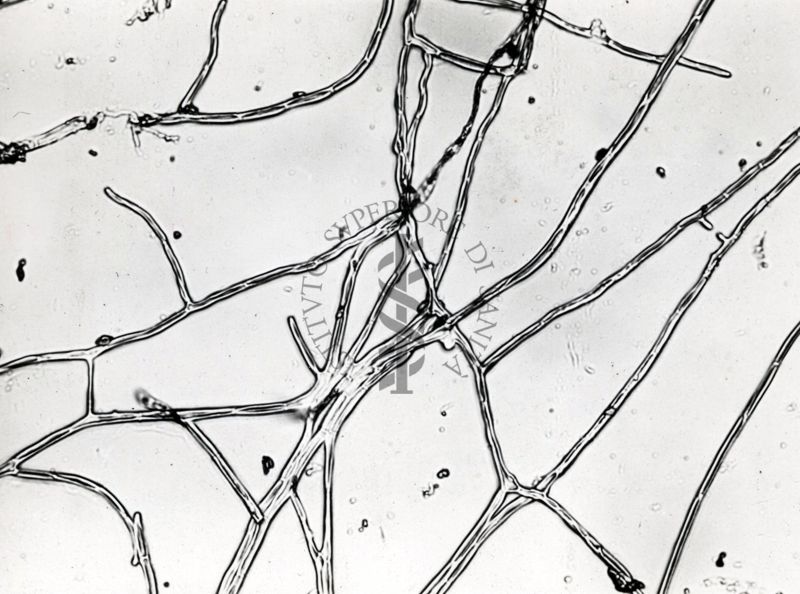 Saccaromiceti. Saccharomyces è un genere del regno dei funghi che include molte specie di lieviti. Il termine deriva dal latino: fungo dello zucchero.