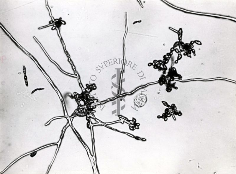 Saccaromiceti. Saccharomyces è un genere del regno dei funghi che include molte specie di lieviti. Il termine deriva dal latino: fungo dello zucchero.