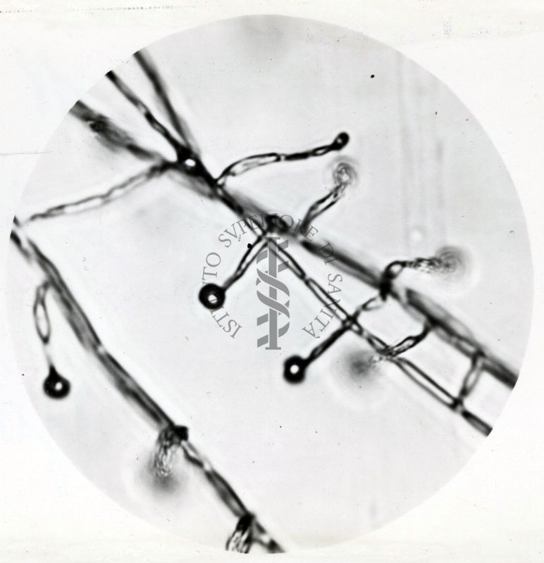 Saccaromiceti. Saccharomyces è un genere del regno dei funghi che include molte specie di lieviti. Il termine deriva dal latino: fungo dello zucchero.