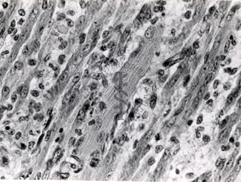 Miosite da virus Coxsackie in topino lattante. Le miositi sono un gruppo eterogeneo di malattie muscolari acquisite, accomunate dall'infiammazione del tessuto muscolare striato. Esse fanno parte del più ampio gruppo delle connettiviti , tra le cui forme rientrano le polimiosite e la dermatomiosite.