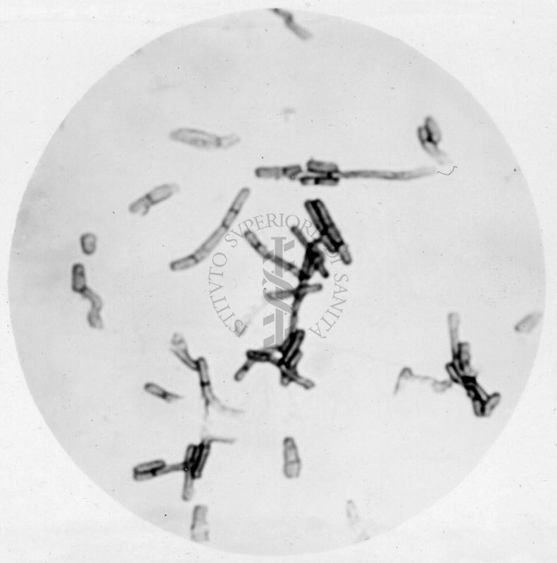 Studio morfologico di lactobacilli al microscopio