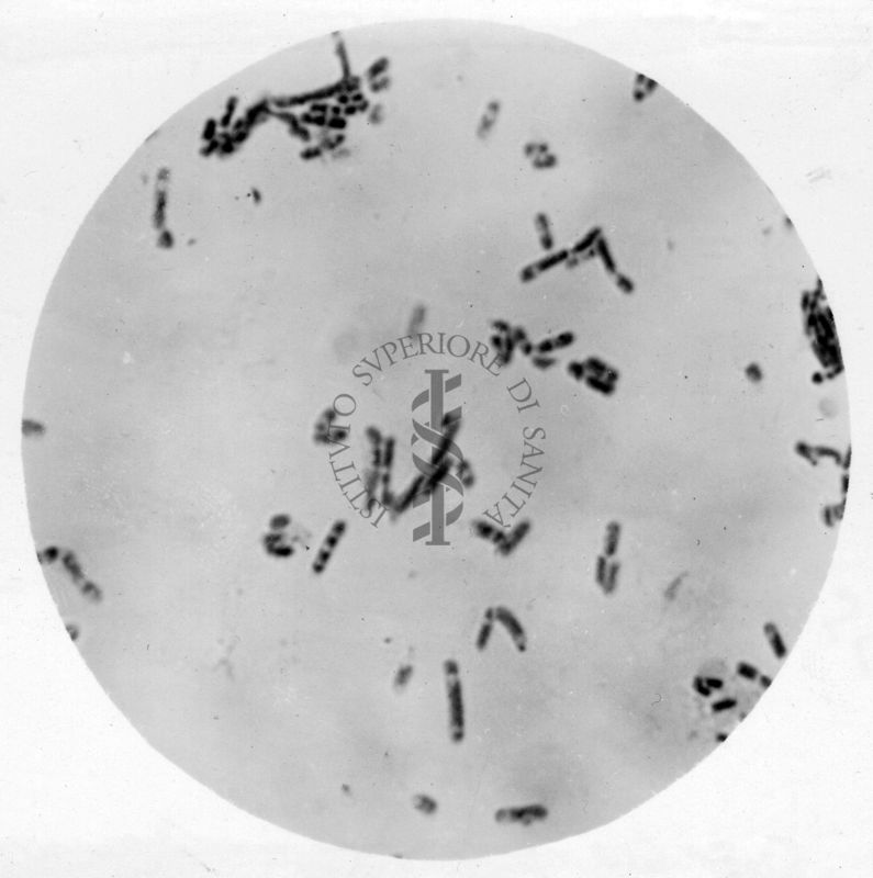 Studio morfologico di lactobacilli al microscopio