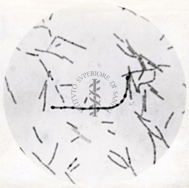 Studio morfologico di lactobacilli al microscopio