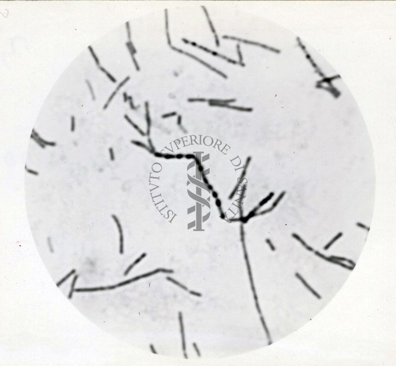 Studio morfologico di lactobacilli al microscopio