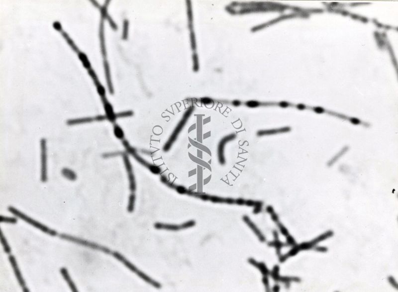 Studio morfologico di lactobacilli al microscopio