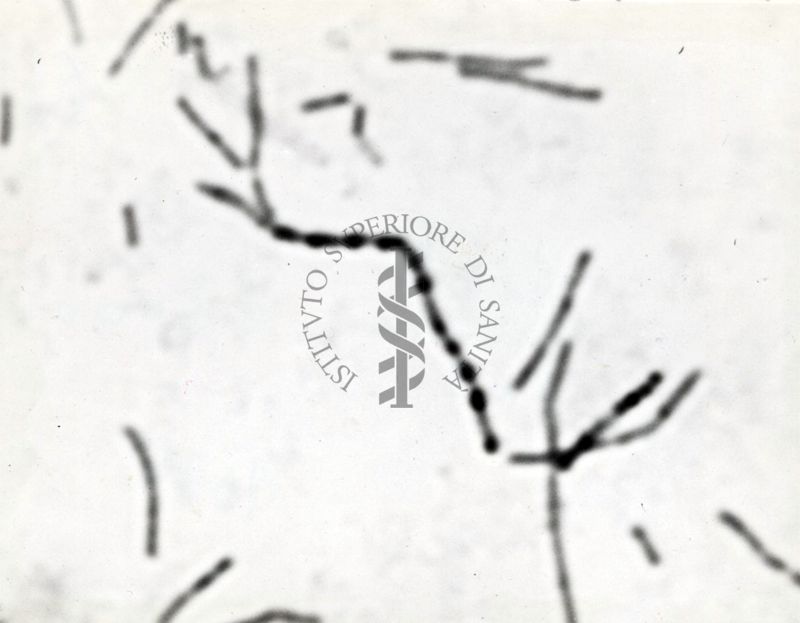 Studio morfologico di lactobacilli al microscopio