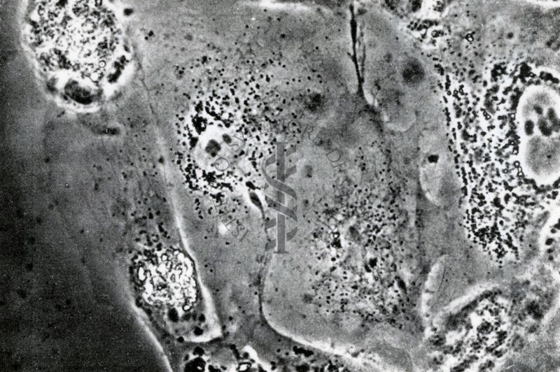 Coltura su tessuto del virus polio 26 dopo l'infezione