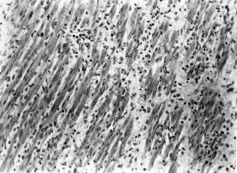 Cartogramma riguardante la leptospirosi (infezione causata da uno dei diversi sierotipi patogeni delle spirochete)