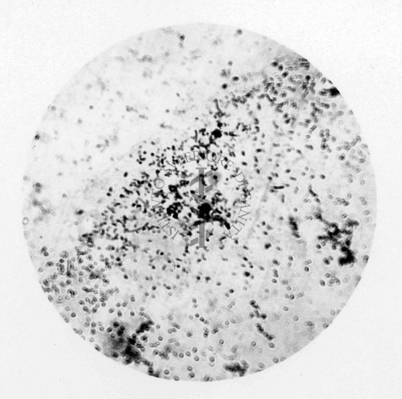 Rickettsia prowazekii coltivata nell'uovo fecondato (da un vaccino)