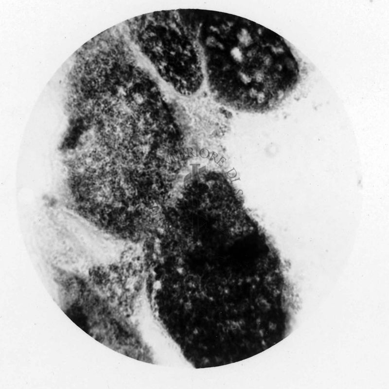 Rickettsia rooshe limae (sezione parete intestinale pidocchio, cellule globose contenenti le Rickettsie)