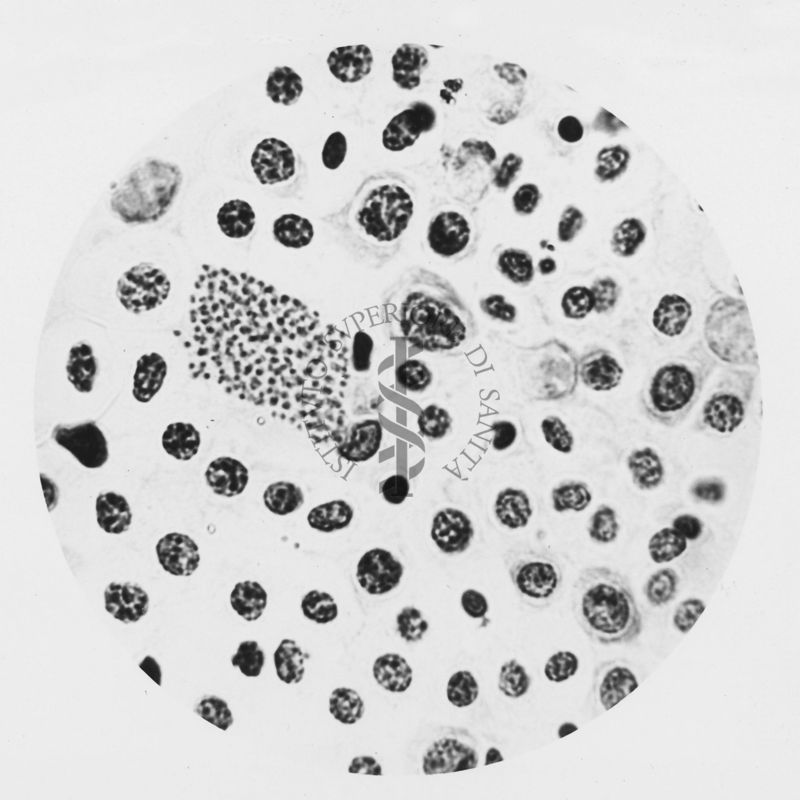 Plasmodium gallinaceum: midollo osseo, cellule istiocitarie con forme di sviluppo del parassita