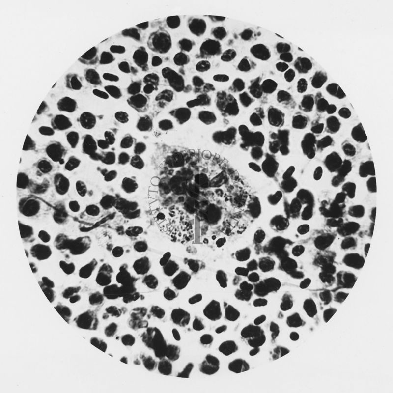 Plasmodium elongatum: cellule istiocitarie in fagocitosi