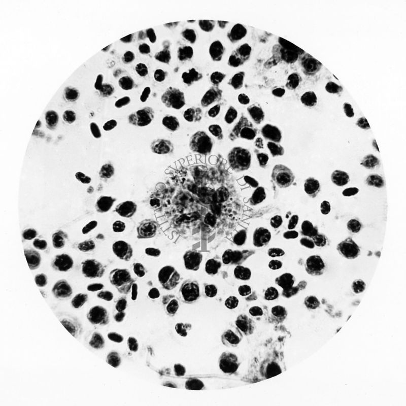 Plasmodium elongatum: cellule istiocitarie in fagocitosi