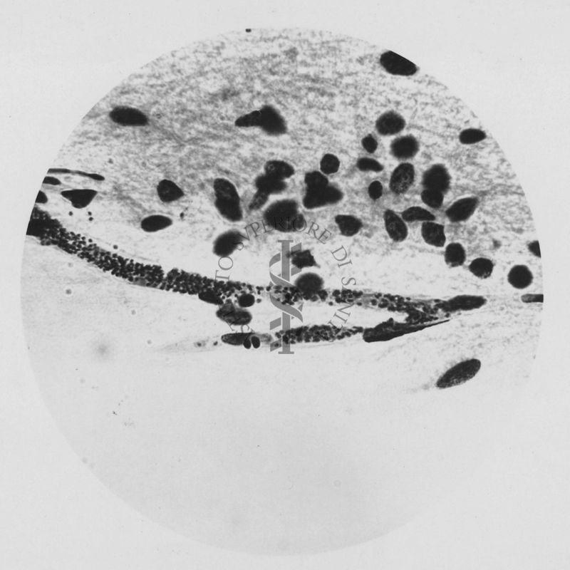 Plasmodium gallinaceum: capillari cerebrali forme endoiestiacitarie