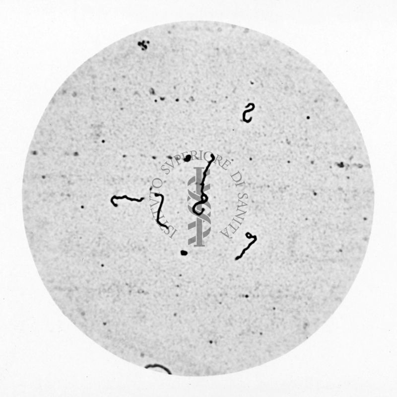 Leptospira ictero_haemorrhagiae forme brevi