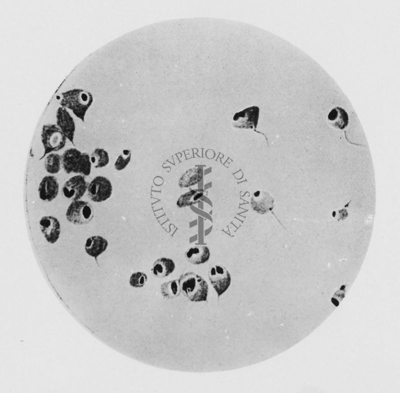 Aspetti del Tripanosoma gambiense, nel liquido cefalo rachidiano di individui colpiti da malattia del sonno