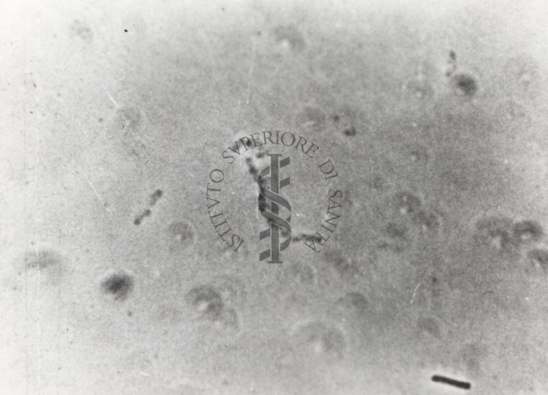 Differenti immagini del Batteriofago. Si tratta di un virus che infetta esclusivamente i batteri e sfrutta il loro apparato biosintetico per effettuare la replicazione virale.