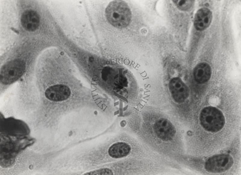 Cariocinesi (divisione indiretta del nucleo nella divisione cellulare) nelle colture in vitro.