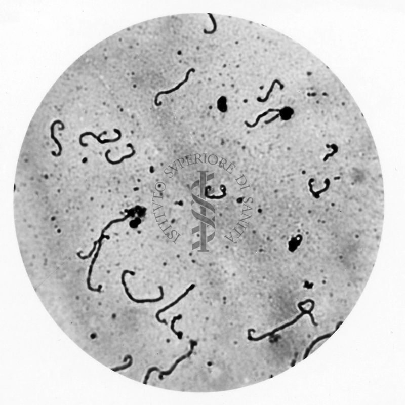 Leptospira