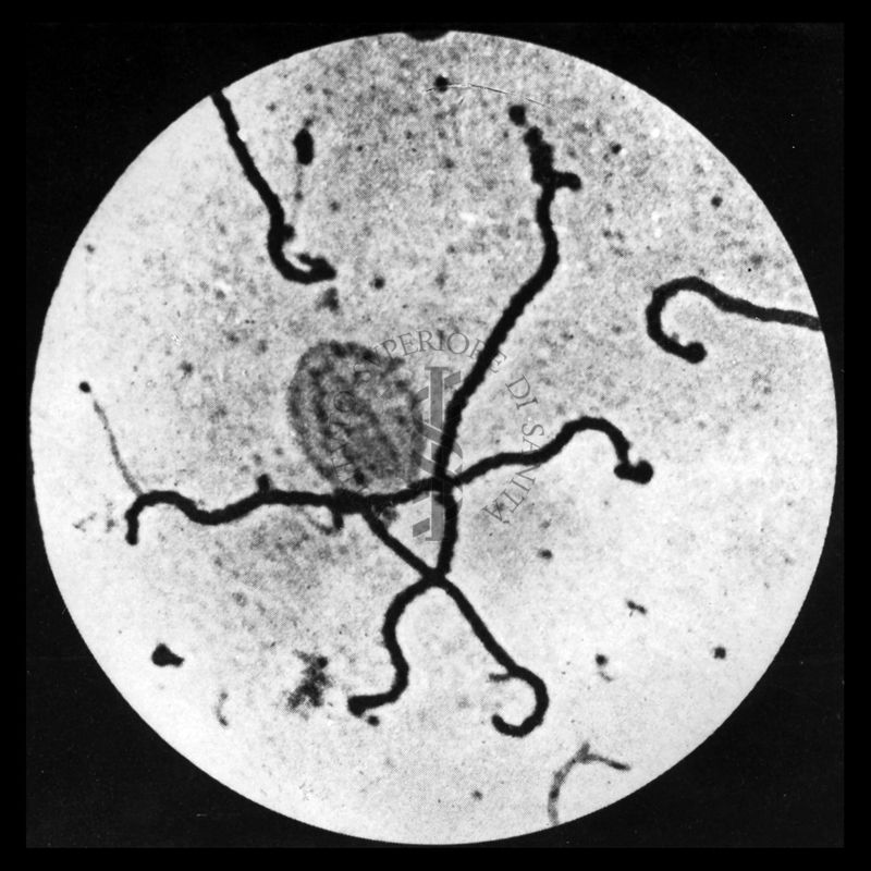 Leptospira icterohaemorrhagiae